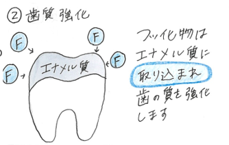 歯質強化